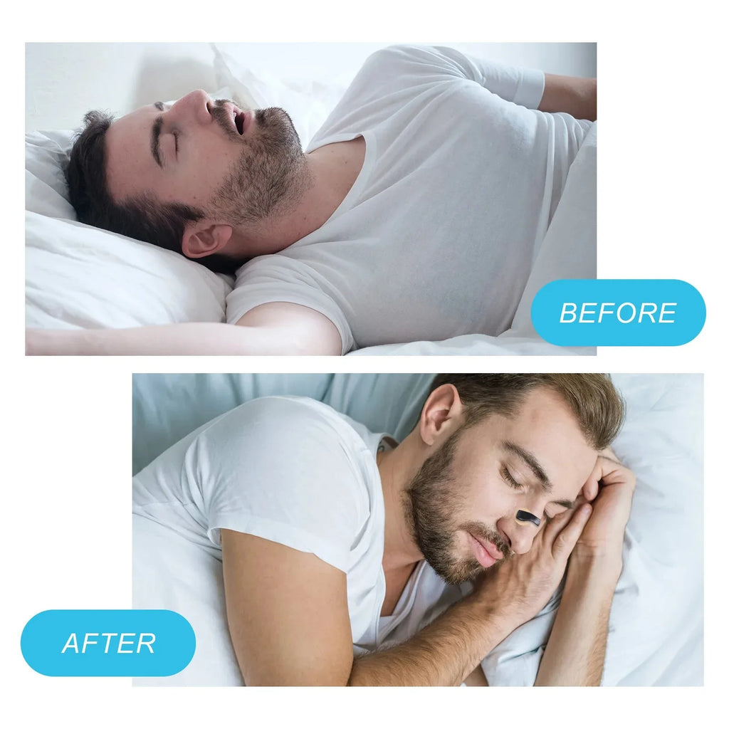 Magnetic Nose Strips Intake Breathing Anti-Snoring Nose Clip Nasal Breathing Dilators Kits Increase Sports Air Improve Sleeping