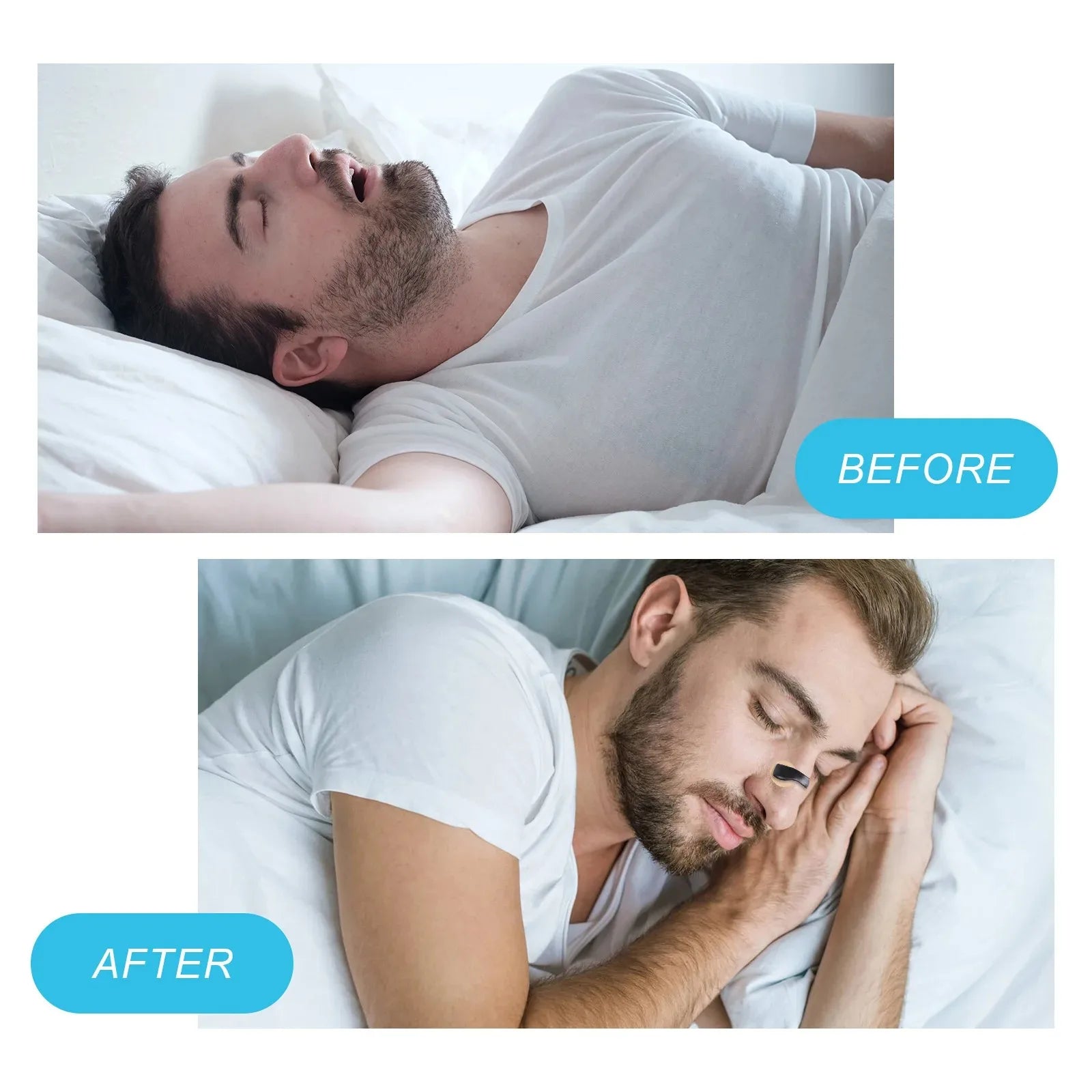 Magnetic Nose Strips Intake Breathing Anti-Snoring Nose Clip Nasal Breathing Dilators Kits Increase Sports Air Improve Sleeping